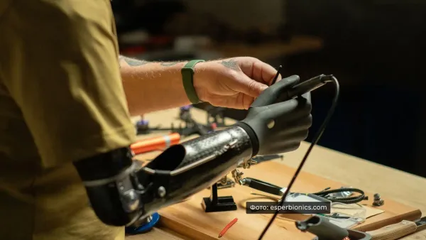 В Україні готують перезавантаження системи протезування