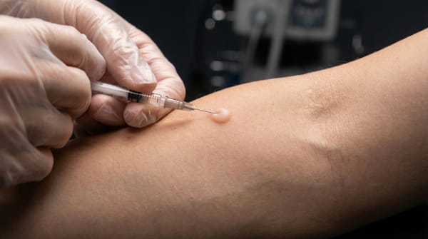 ТВГІ замість Манту: в Україні стартує перехід на сучасну діагностику туберкульозу